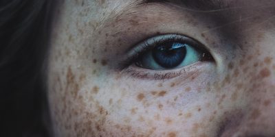 Lighten and Reduce Freckles